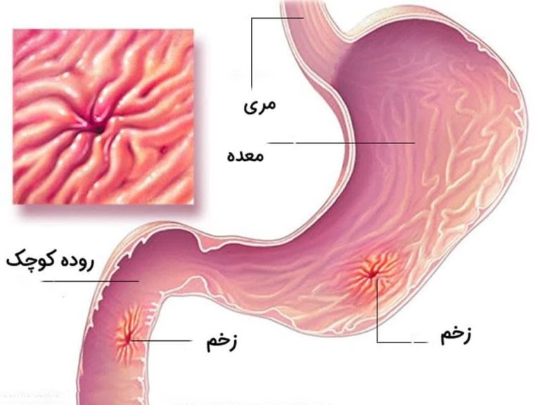 صفرا